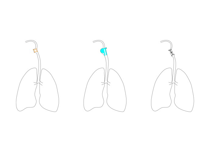 vocal experimentation